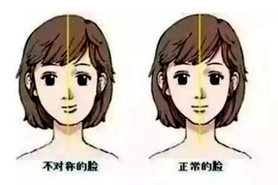 為什么左右臉不對稱,大小臉怎么糾正