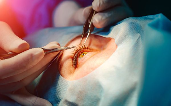 人為什么會(huì)近視,近視眼形成的原理是什么